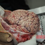 Autopsy of stabbed girl