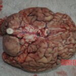 Autopsy of stabbed girl