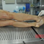 Autopsy of stabbed girl