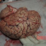 Autopsy of stabbed girl