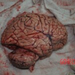 Autopsy of stabbed girl