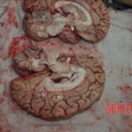 Autopsy of stabbed girl