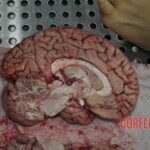 Autopsy of stabbed girl