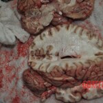 Autopsy of stabbed girl