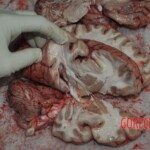 Autopsy of stabbed girl