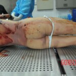 Autopsy of stabbed girl