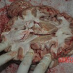 Autopsy of stabbed girl