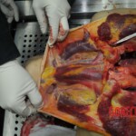 Autopsy of stabbed girl