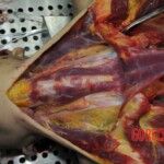 Autopsy of stabbed girl