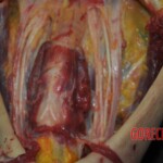 Autopsy of stabbed girl