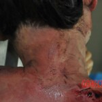 Autopsy of stabbed girl