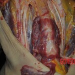 Autopsy of stabbed girl