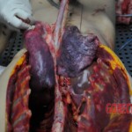 Autopsy of stabbed girl