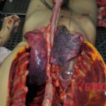 Autopsy of stabbed girl