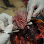 Autopsy of stabbed girl