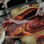 Autopsy of stabbed girl