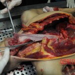 Autopsy of stabbed girl