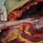 Autopsy of stabbed girl