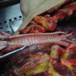 Autopsy of stabbed girl