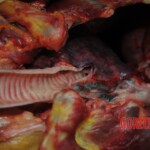 Autopsy of stabbed girl