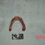 Autopsy of stabbed girl