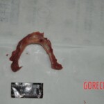 Autopsy of stabbed girl
