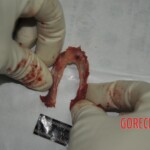 Autopsy of stabbed girl