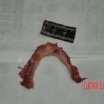 Autopsy of stabbed girl