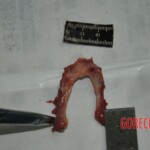 Autopsy of stabbed girl