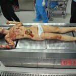 Autopsy of stabbed girl