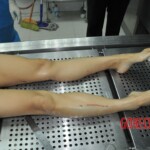 Autopsy of stabbed girl