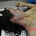 Autopsy of stabbed girl