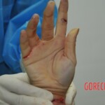 Autopsy of stabbed girl