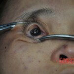 Autopsy of stabbed girl