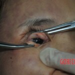 Autopsy of stabbed girl