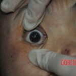 Autopsy of stabbed girl