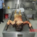 Autopsy of stabbed girl