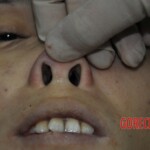 Autopsy of stabbed girl