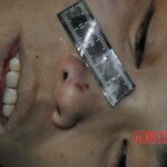 Autopsy of stabbed girl