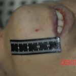 Autopsy of stabbed girl