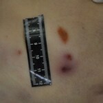 Autopsy of stabbed girl