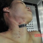 Autopsy of stabbed girl