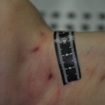 Autopsy of stabbed girl