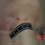 Autopsy of stabbed girl