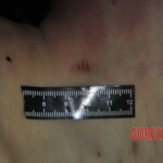 Autopsy of stabbed girl