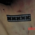 Autopsy of stabbed girl