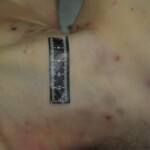 Autopsy of stabbed girl