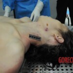 Autopsy of stabbed girl