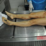 Autopsy of stabbed girl