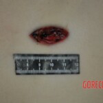 Autopsy of stabbed girl